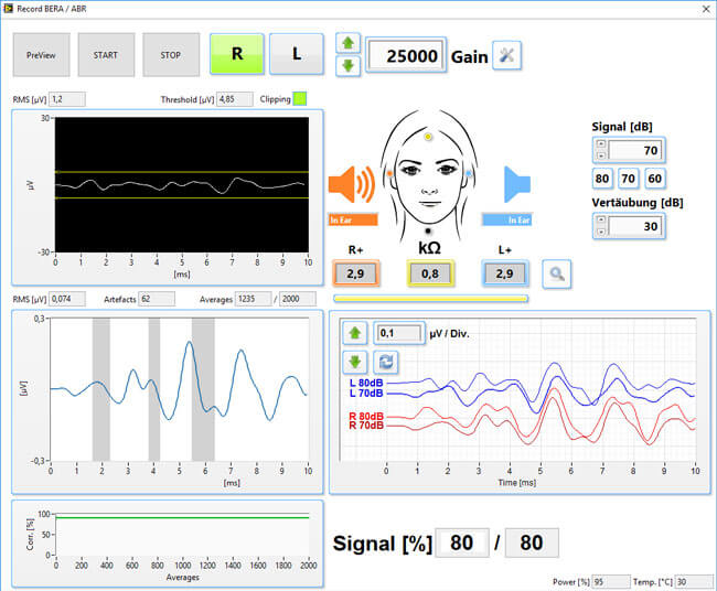 biomed-eabr-display