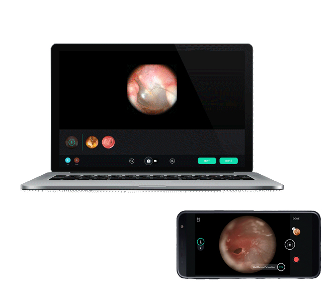 Digital Video Otoscope